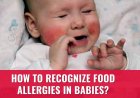 Food Allergies in Babies: Causes, Symptoms, Diagnosis and Treatment