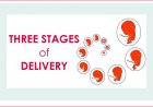 Three stages of Delivery