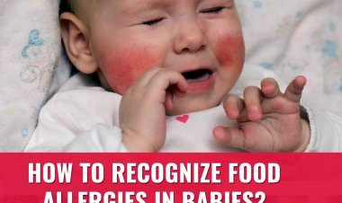 Food Allergies in Babies: Causes, Symptoms, Diagnosis and Treatment