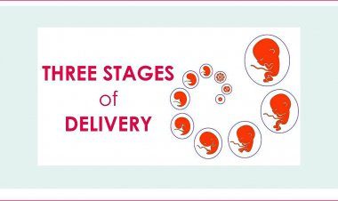 Three stages of Delivery