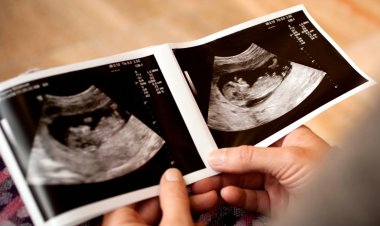 Know what are the symptoms of having a boy in the womb