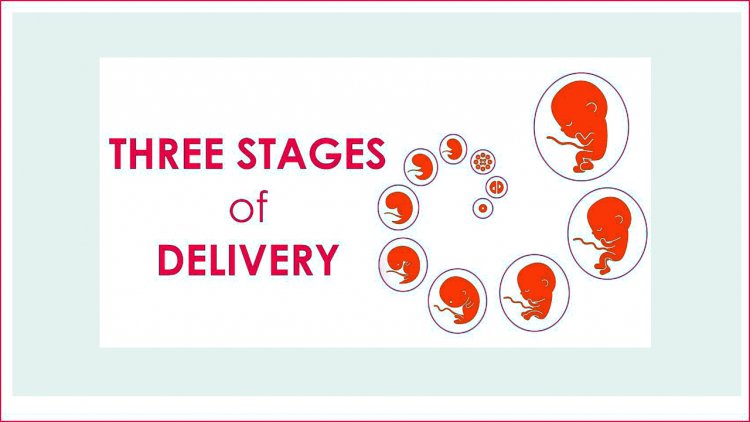 Three stages of Delivery